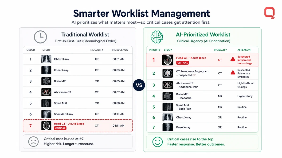The benefits of AI-assisted radiology across the imaging workflow